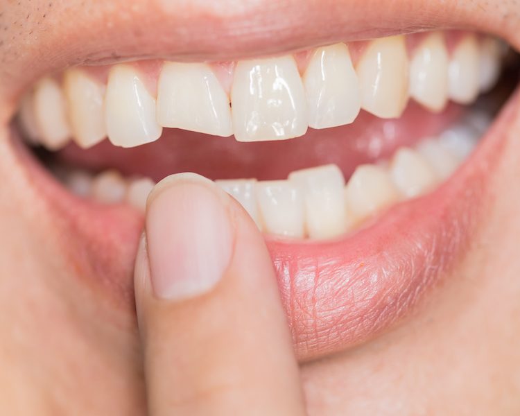teeth